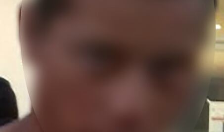 Cae de la azotea y se lesiona, al intentar allanar vivienda 