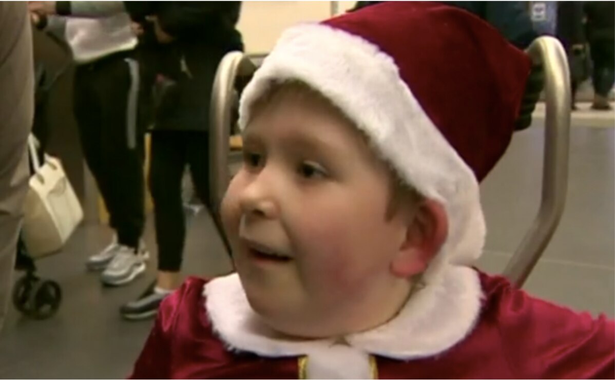 El asombroso caso del niño inglés que nació con solo el 2% del cerebro