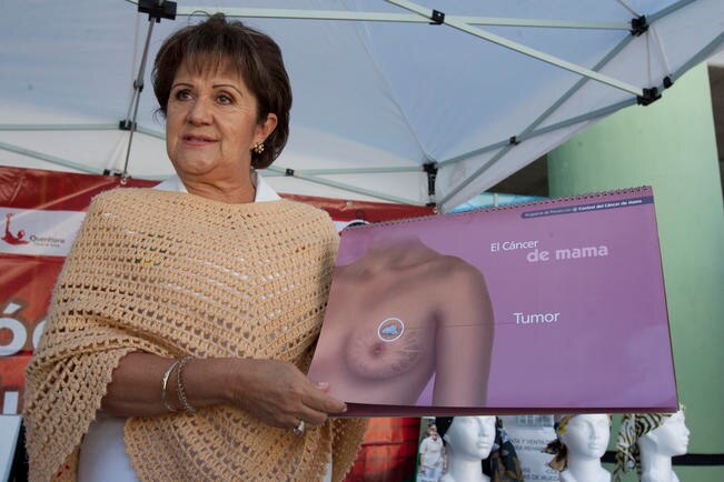 IMSS: al mes, 15 nuevos casos de cáncer de mama 