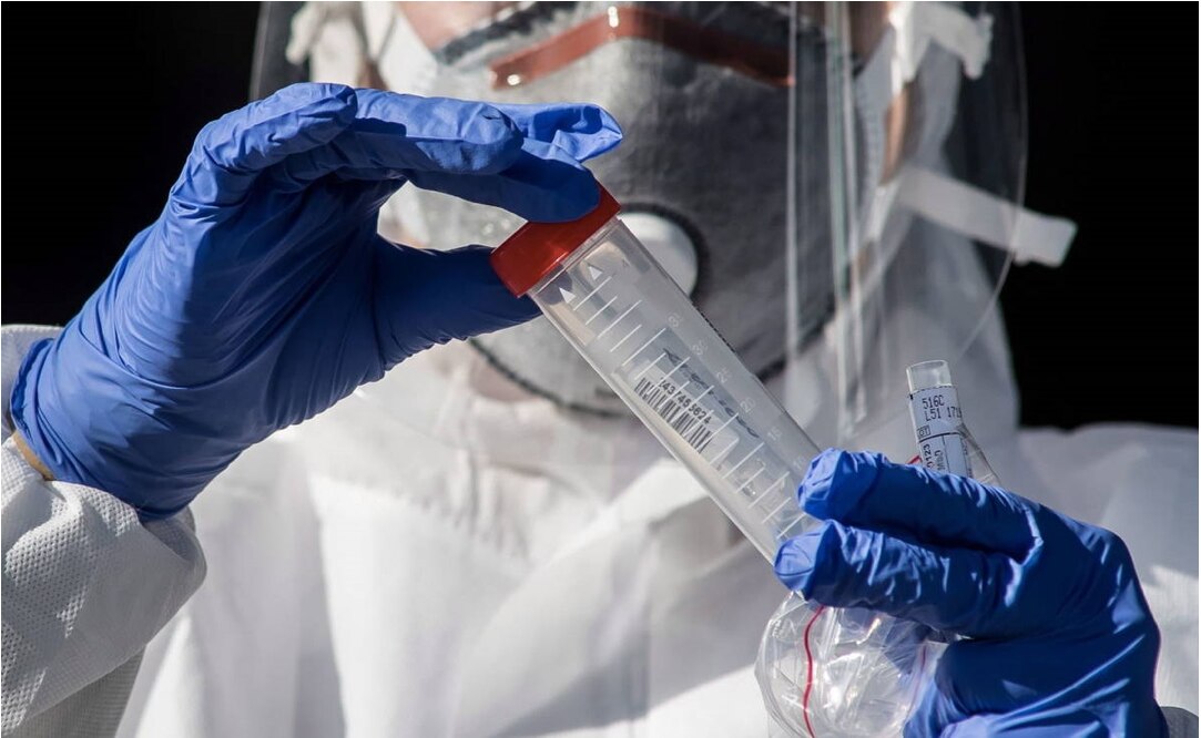 Vacuna de AstraZeneca y Oxford causa fuerte respuesta contra el Covid, según estudio