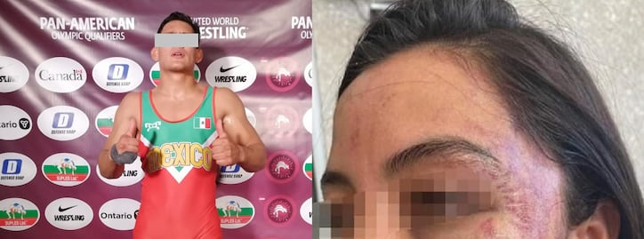Atleta queretano acusado de violencia de género; golpeó a su novia  