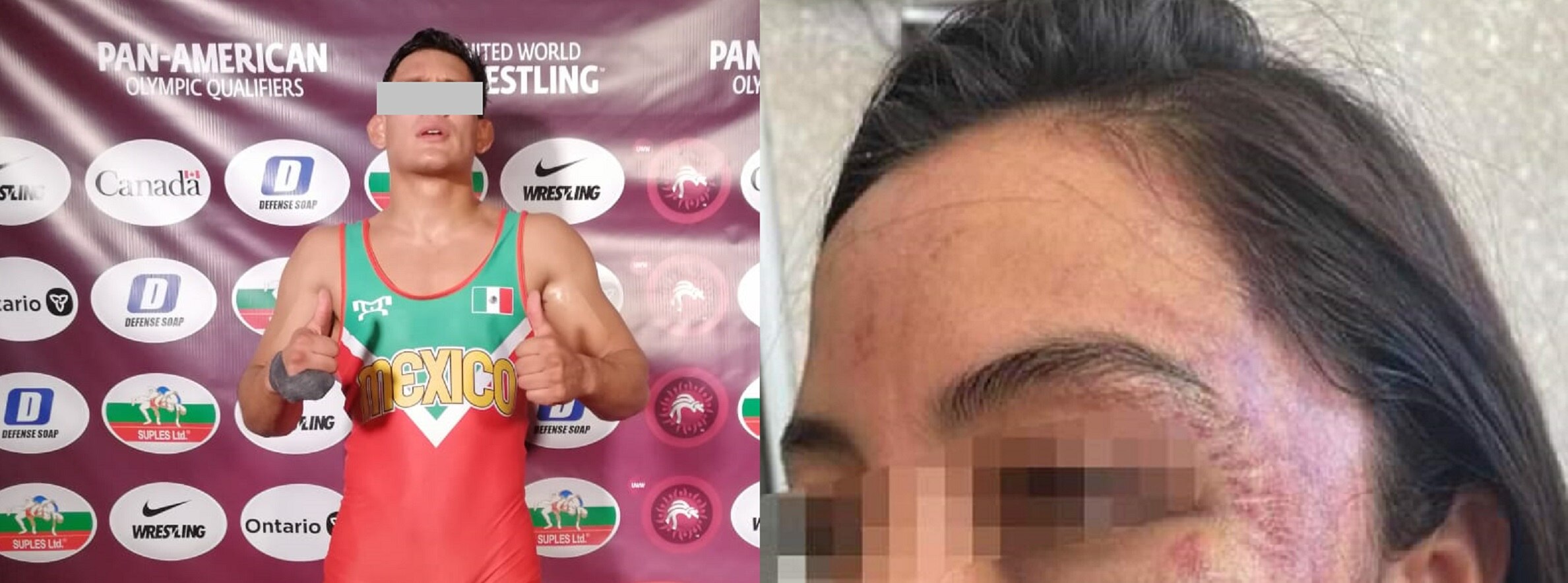 Atleta queretano acusado de violencia de género; golpeó a su novia