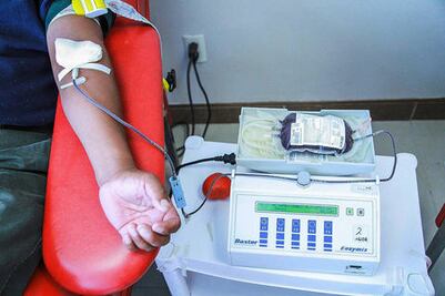 Logran medir glucosa con electricidad 