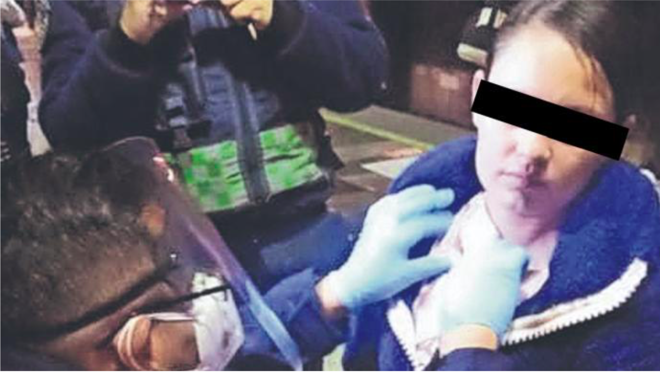 Asaltante ataca y tasajea a mujer policía afuera del Metro Guelatao, en la CDMX