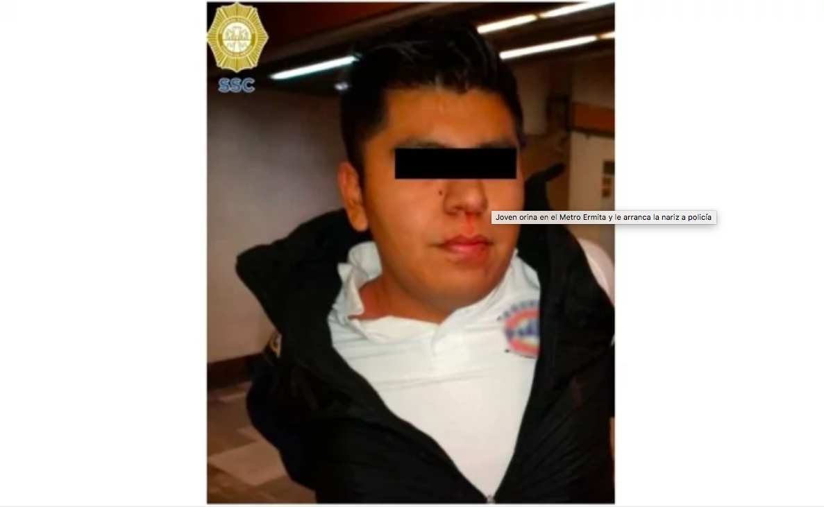 Joven orina en Metro Ermita y le arranca pedazo de nariz a polic&iacute;a que intent&oacute; detenerlo